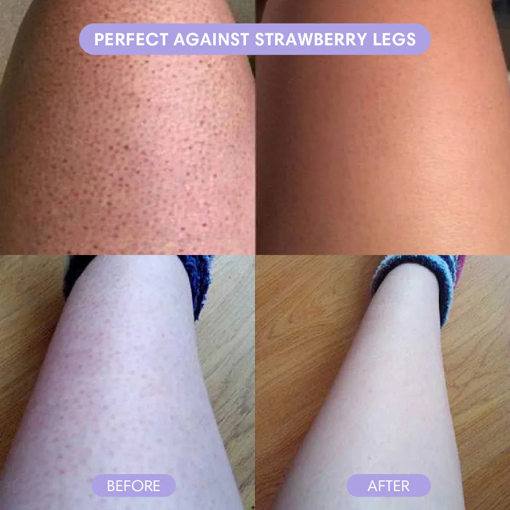 Body Hair Removal Cream