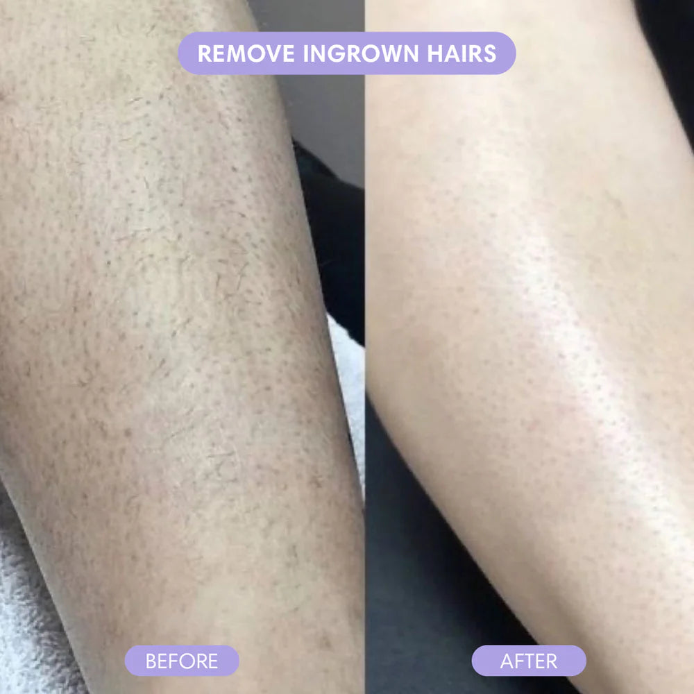 Body Hair Removal Cream